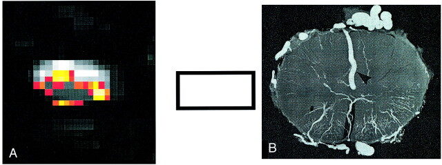 fig 4.