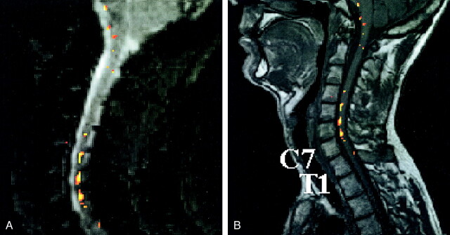 fig 3.