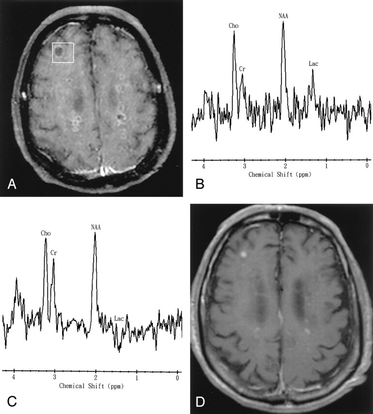 Fig 3.