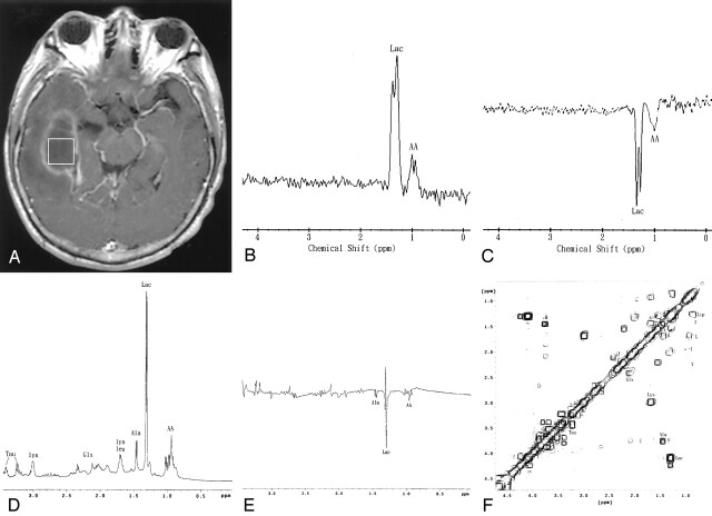 Fig 2.