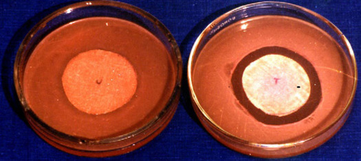 Figure 5.1