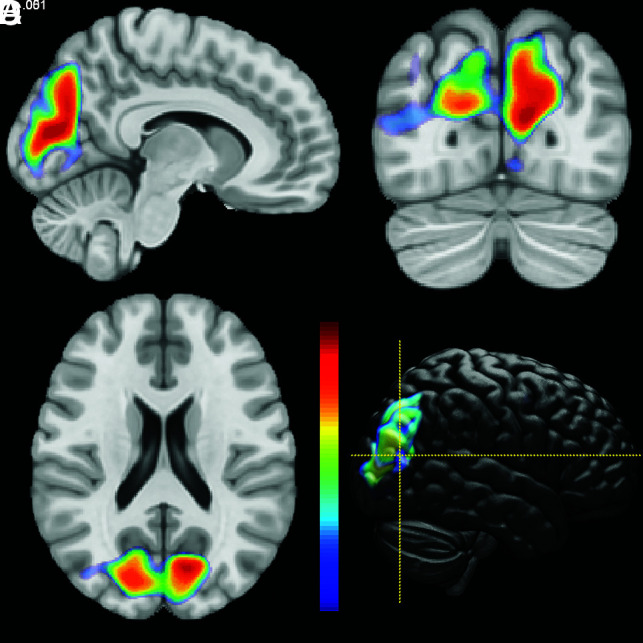 FIG 2.