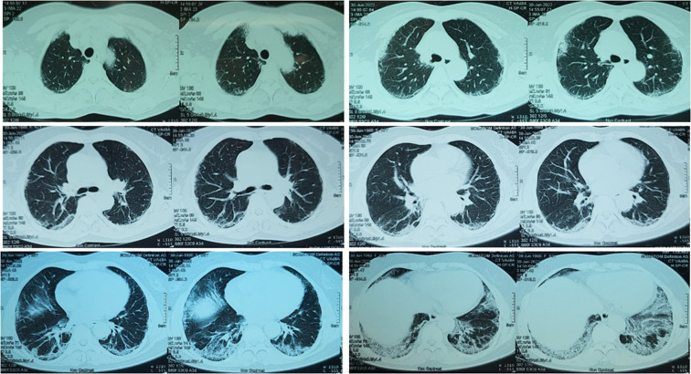 Fig. 3