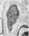 61P