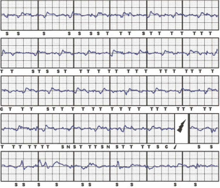 Fig. 1