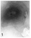 Fig. 1. 2.