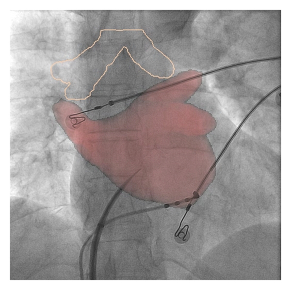 Figure 5