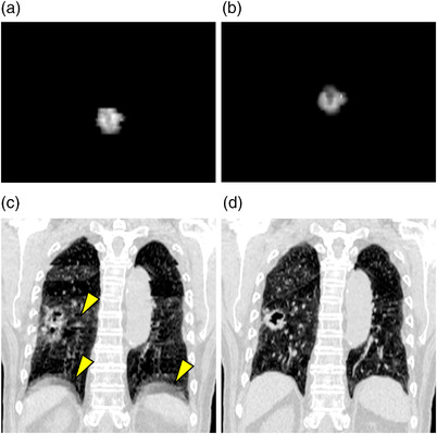 FIGURE 4