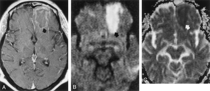 Fig 2.