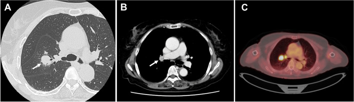 Fig. 1