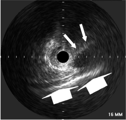 Fig. (9)