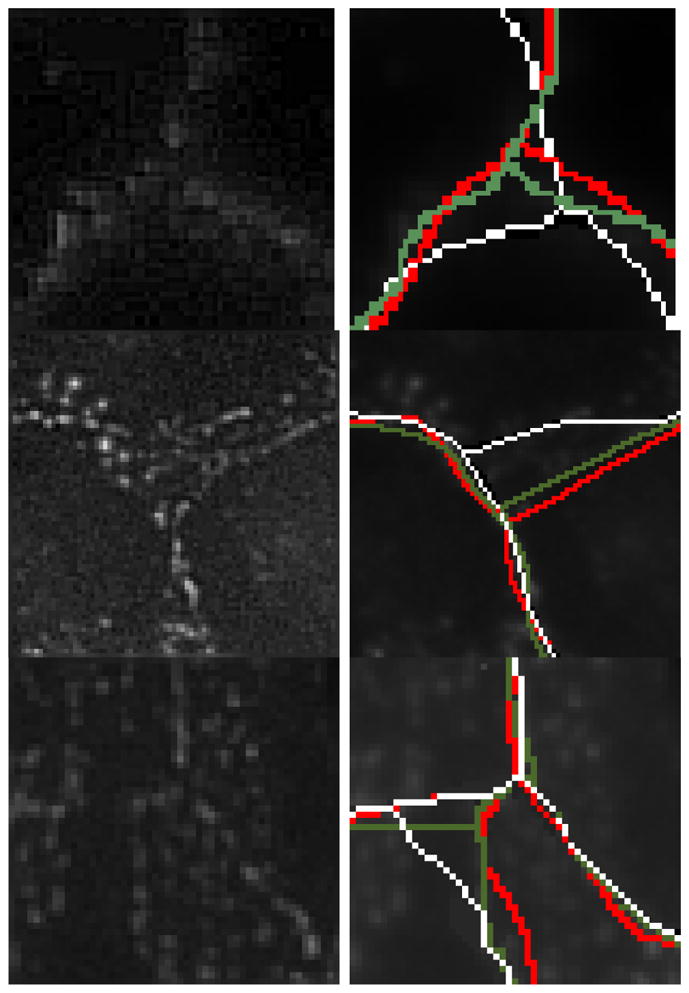 Fig. 18