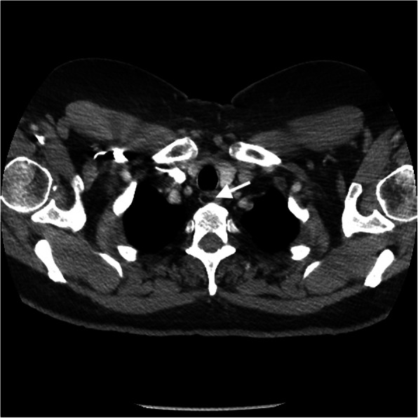 Fig. 13