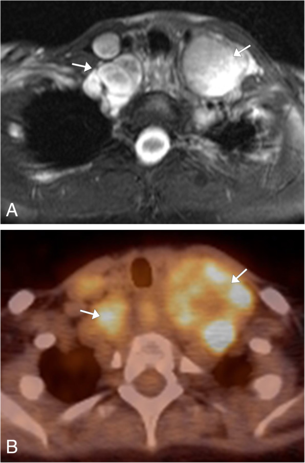 Fig. 11