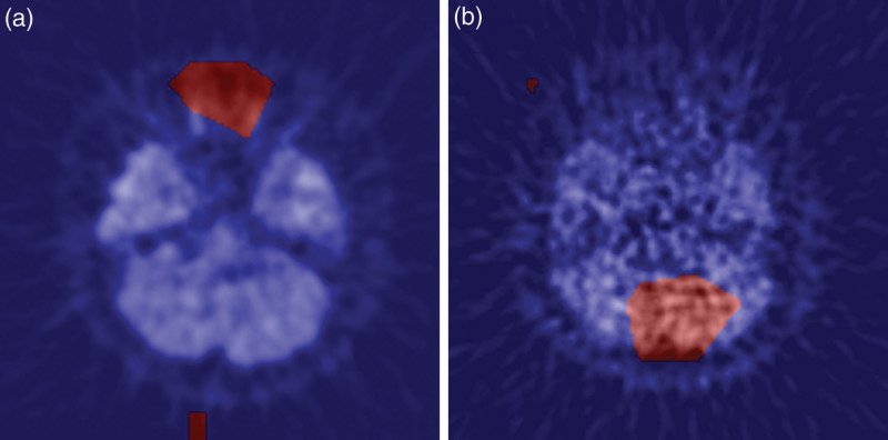 Fig. 10