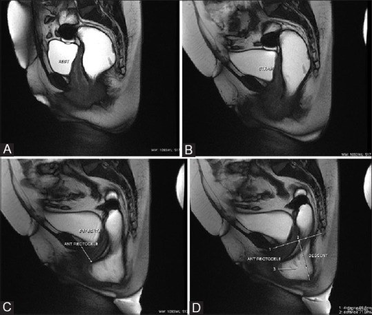 Figure 2(A-D)