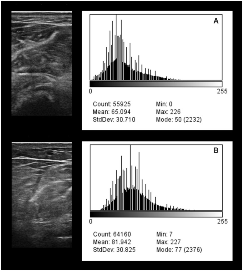 FIGURE 1: