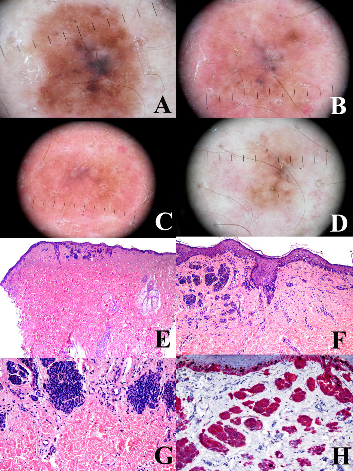 Figure 4