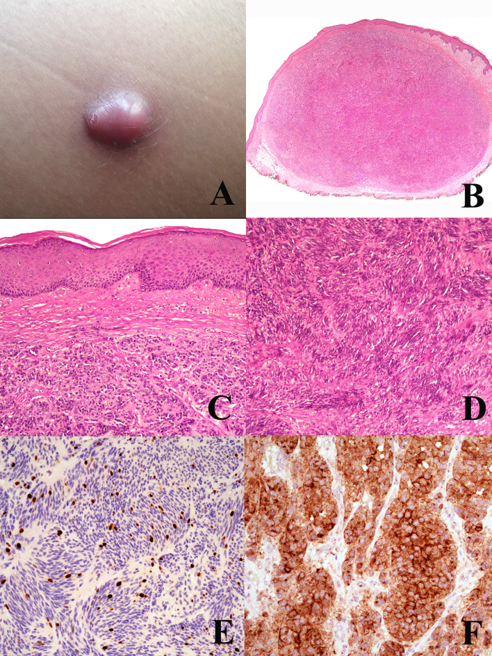 Figure 2