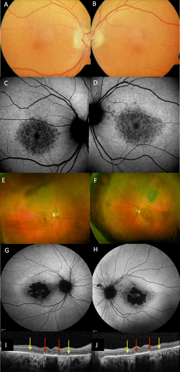 Fig. 5