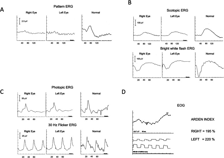 Fig. 2