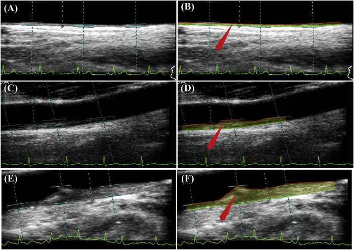 Fig. 1