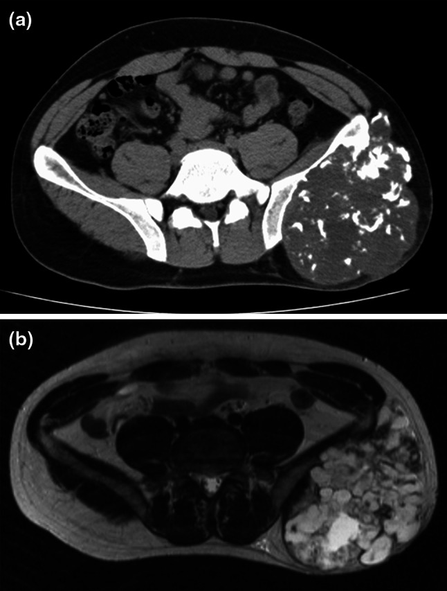 Fig. 1