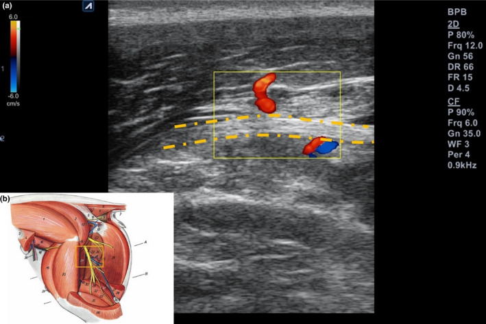 FIGURE 6