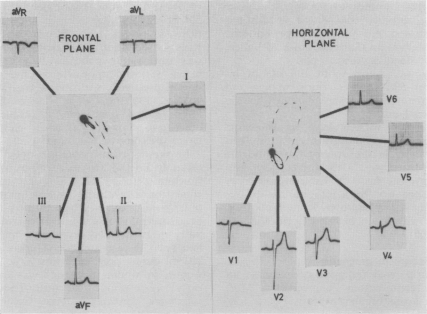 Fig. 11