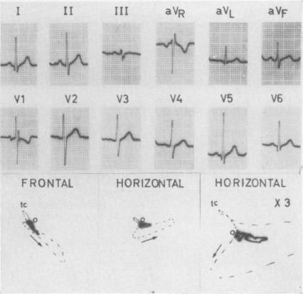 Fig. 10