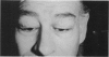 110