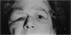 108