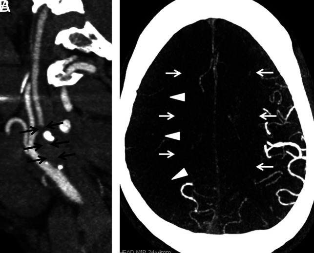 FIG 2.