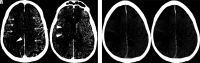 FIG 1.