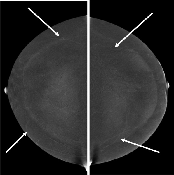 Fig. 10