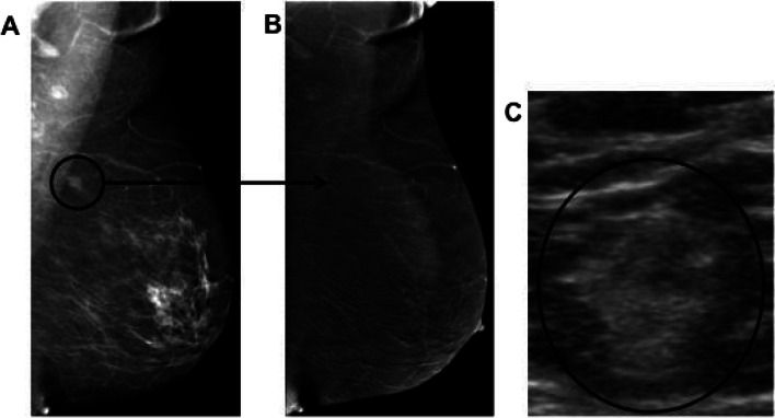 Fig. 11