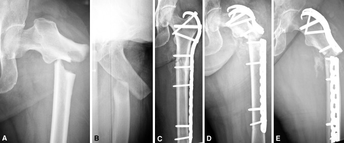 Fig. 1A–E