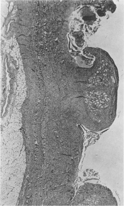 Fig. 5c.