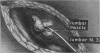 115