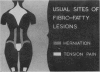 116