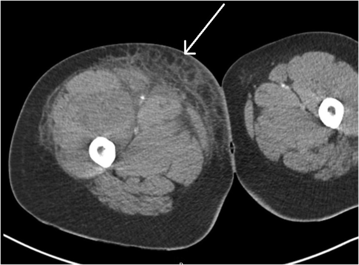 Figure 2 