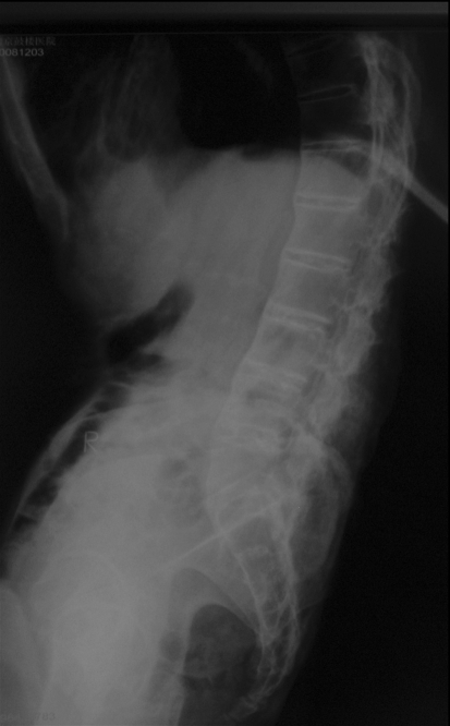 Fig. 1