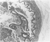 117