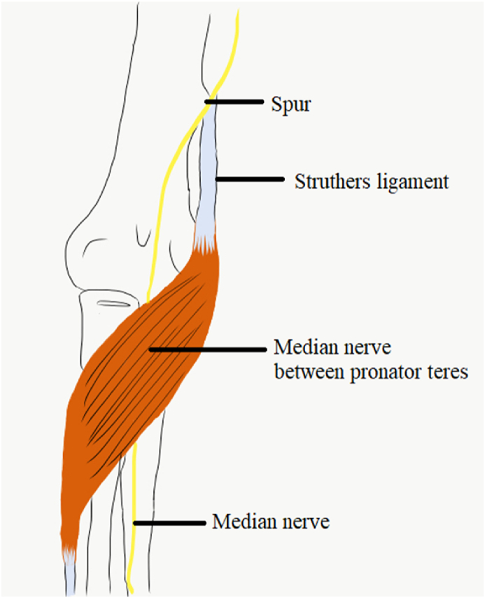 Fig. 4