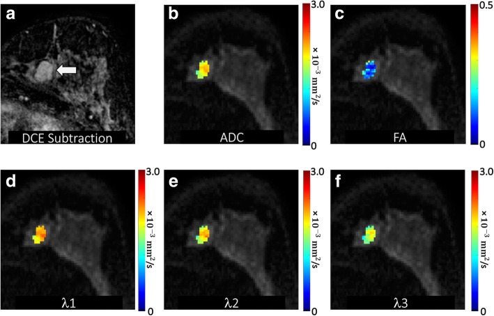 Fig. 2