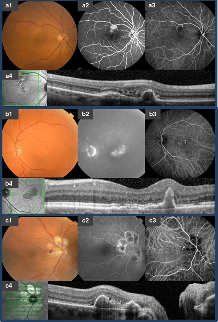 Fig. 1