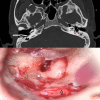 Fig. 1