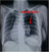 Fig. 9