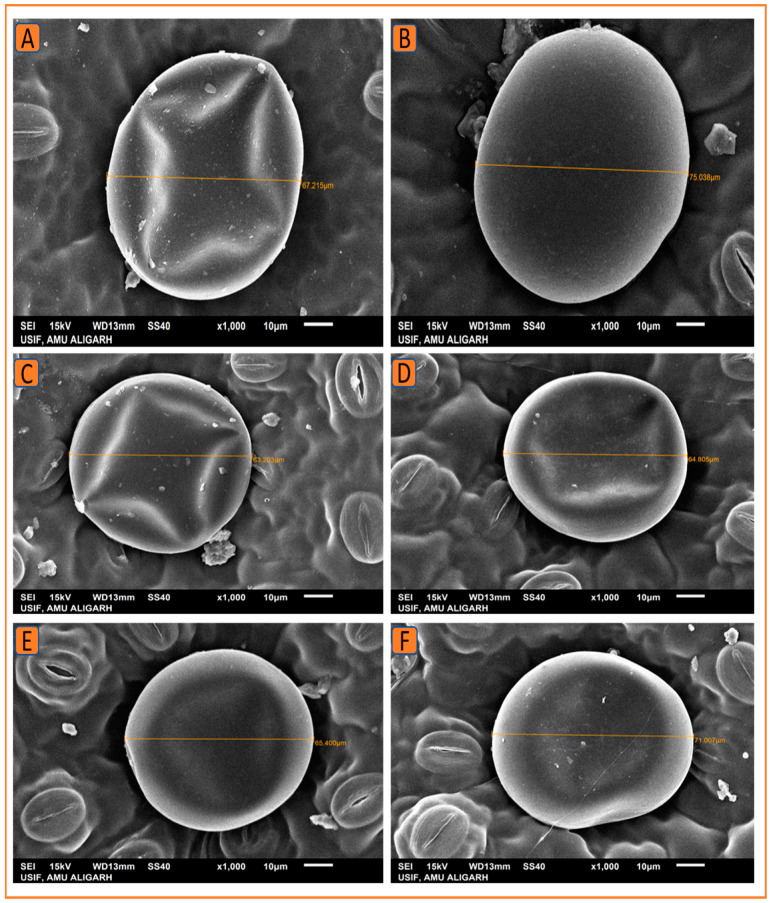 Figure 11