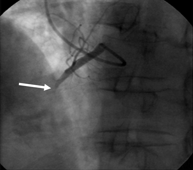 Figure 5a: